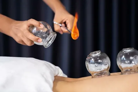 Exploring the Science Behind Chinese Fire Cupping and Its Therapeutic Effects